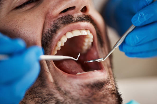 Best Chipped Tooth Repair Near Me  in Cheboygan, MI